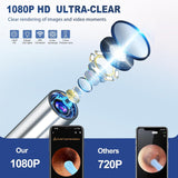 Ear Wax Removal Tool With Camera | 1 Set Portable Type-C Rechargeable Ear Cleaner, Waterproof Endoscope Ear Cleaning Tool, Earwax Removal Tool, Earwax Removal Kit