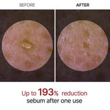 Peel Shot Glow Rice Ampoule Duo - Serums for Brightening, Exfoliating, and Moisturizing - Suitable for All Skin Types