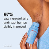 Smoothing Solution Ingrown Hair Treatment: Glide Your Way to Silky-Smooth, Bump-Free Skin