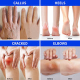 Aavini Intense Foot Cream Aavini Intense Foot Cream
